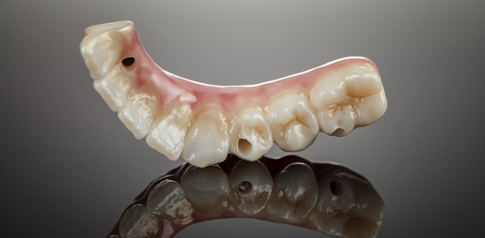 Screw Retained to Base