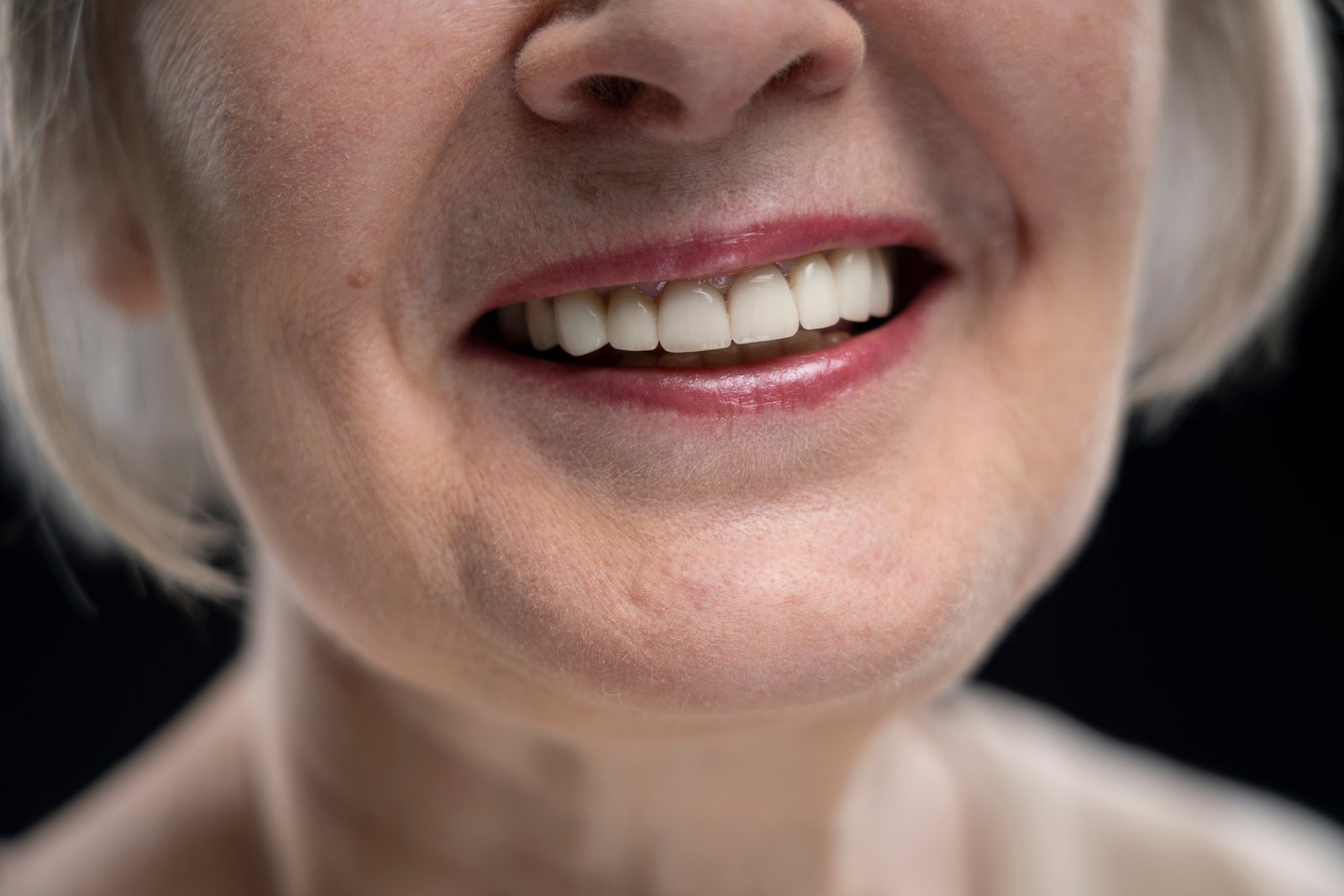Happy patient with dental restoration